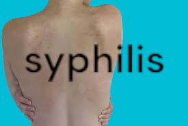 syphilis in females